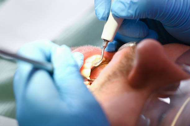 Best Emergency Denture Repair in Mount Olive, IL