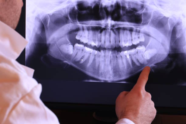 Best Emergency Dental Care for Sports Injuries in Mount Olive, IL
